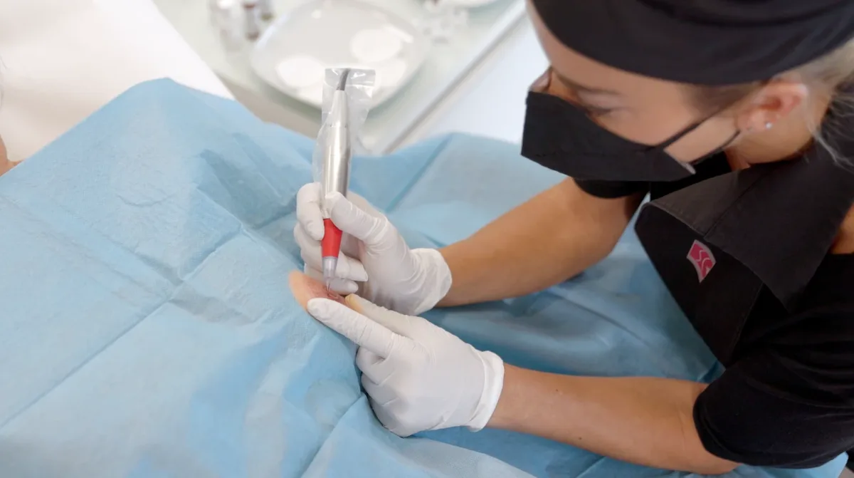 Profesional de FEMPO realiza una reconstrucción del complejo areola-pezón con dermopigmentación oncológica